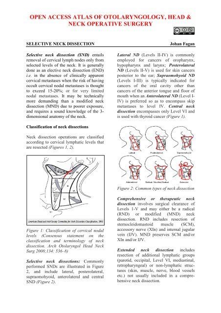 vula glossectomy|partial glossectomy with neck dissection.